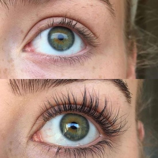 Emily™ - Ihr natürliches Wimpernwachstumsserum!